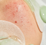 Sensitive Skin Soothing Facial