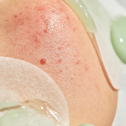 Sensitive Skin Soothing Facial